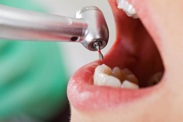 Best Pediatric Emergency Dentist in Erin, TN